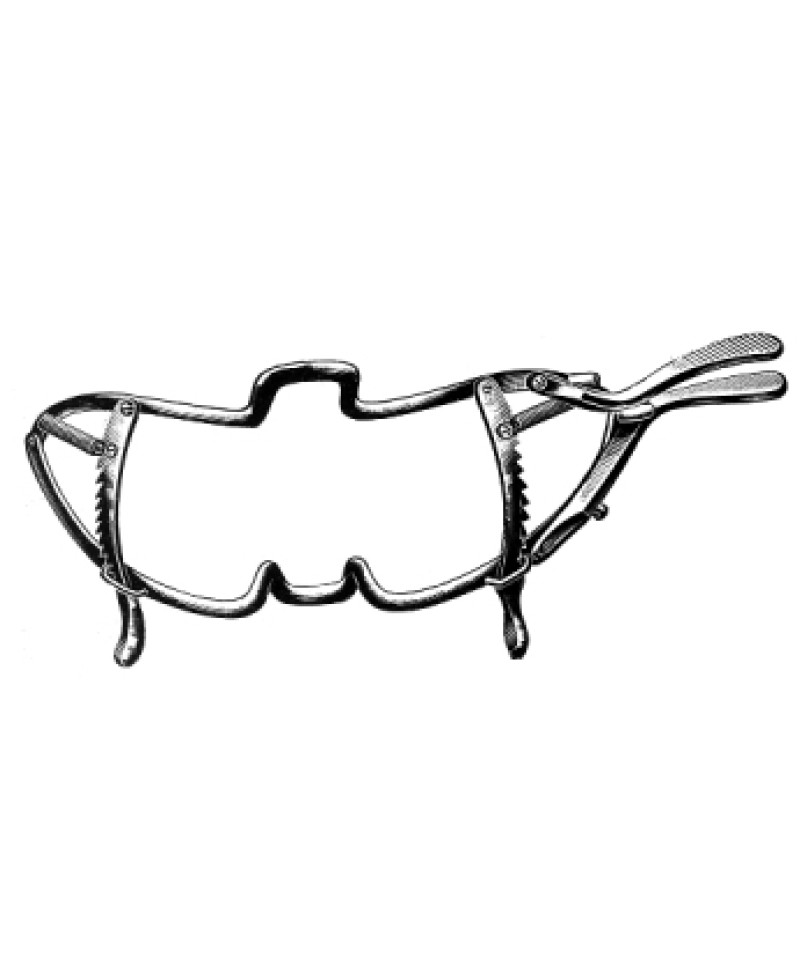 Whitehead Mouth Gag 11cm